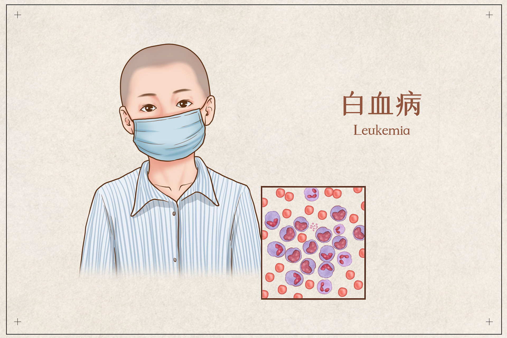 甲醛吸多久，會得白血病?